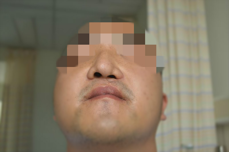 江西小伙"一个鼻孔出气"20年 在深圳重获"微笑脸"