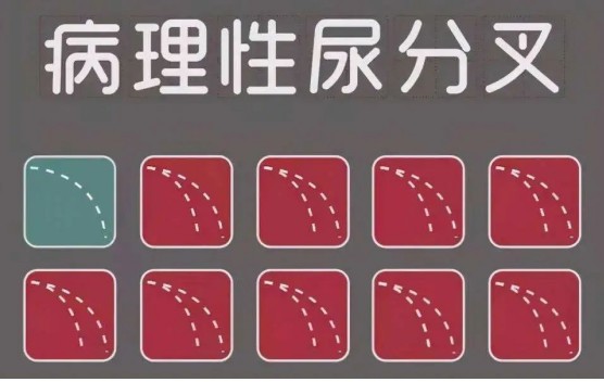 菠萝君带大家一起来分析一下尿液为什么会分叉?